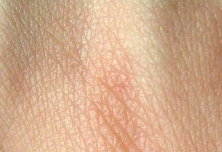 Piel