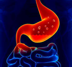 Gastritis